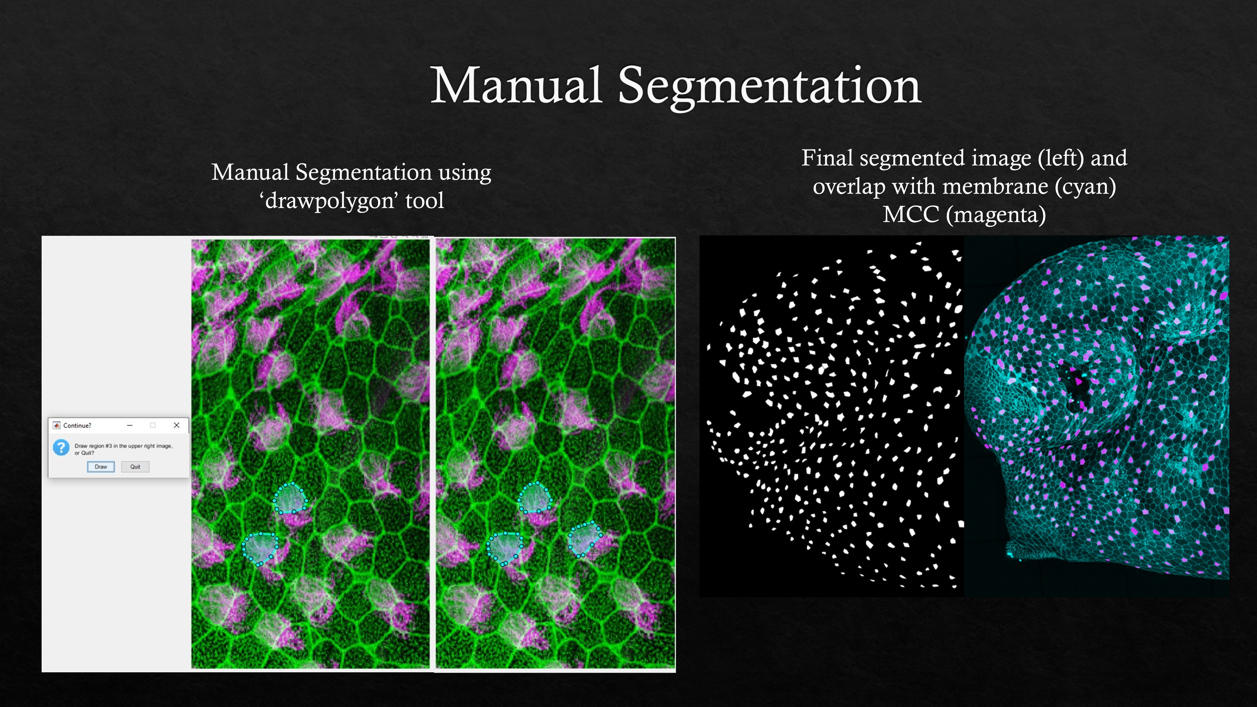Image Segmentation Using MATLAB - Vignesh Aravind: Project Page