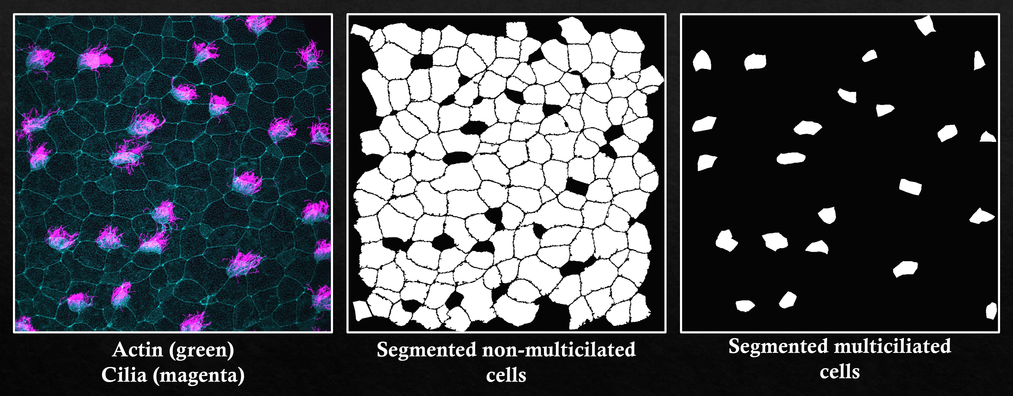 Image Segmentation Using MATLAB - Vignesh Aravind: Project Page