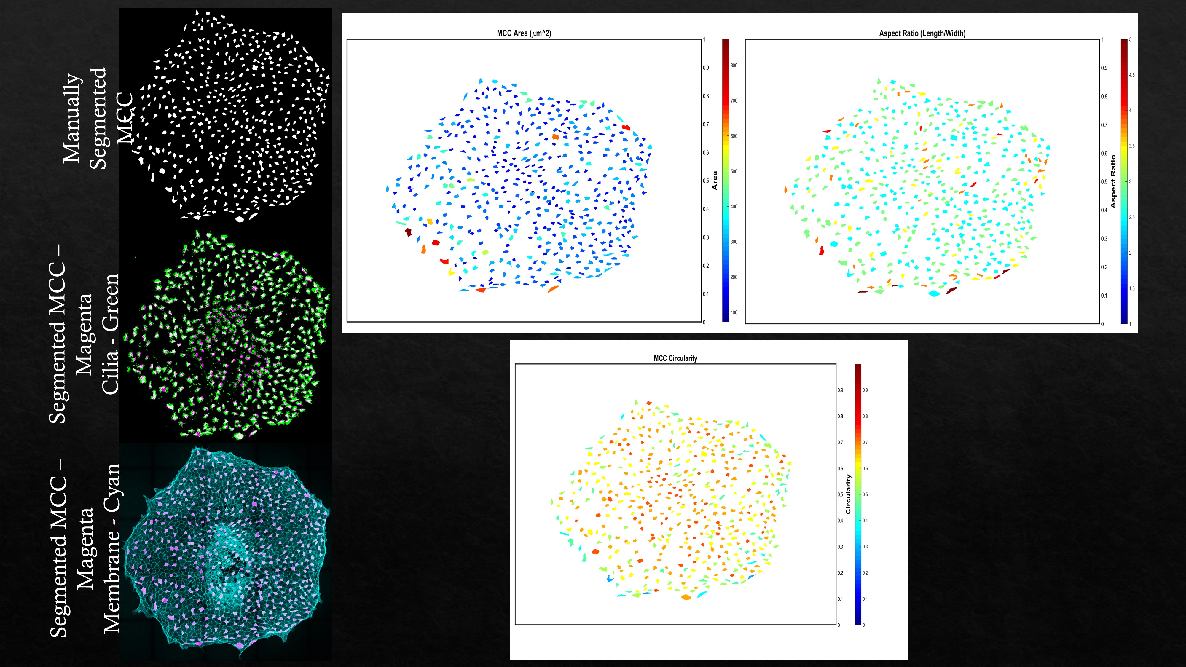 Image Segmentation Using MATLAB - Vignesh Aravind: Project Page