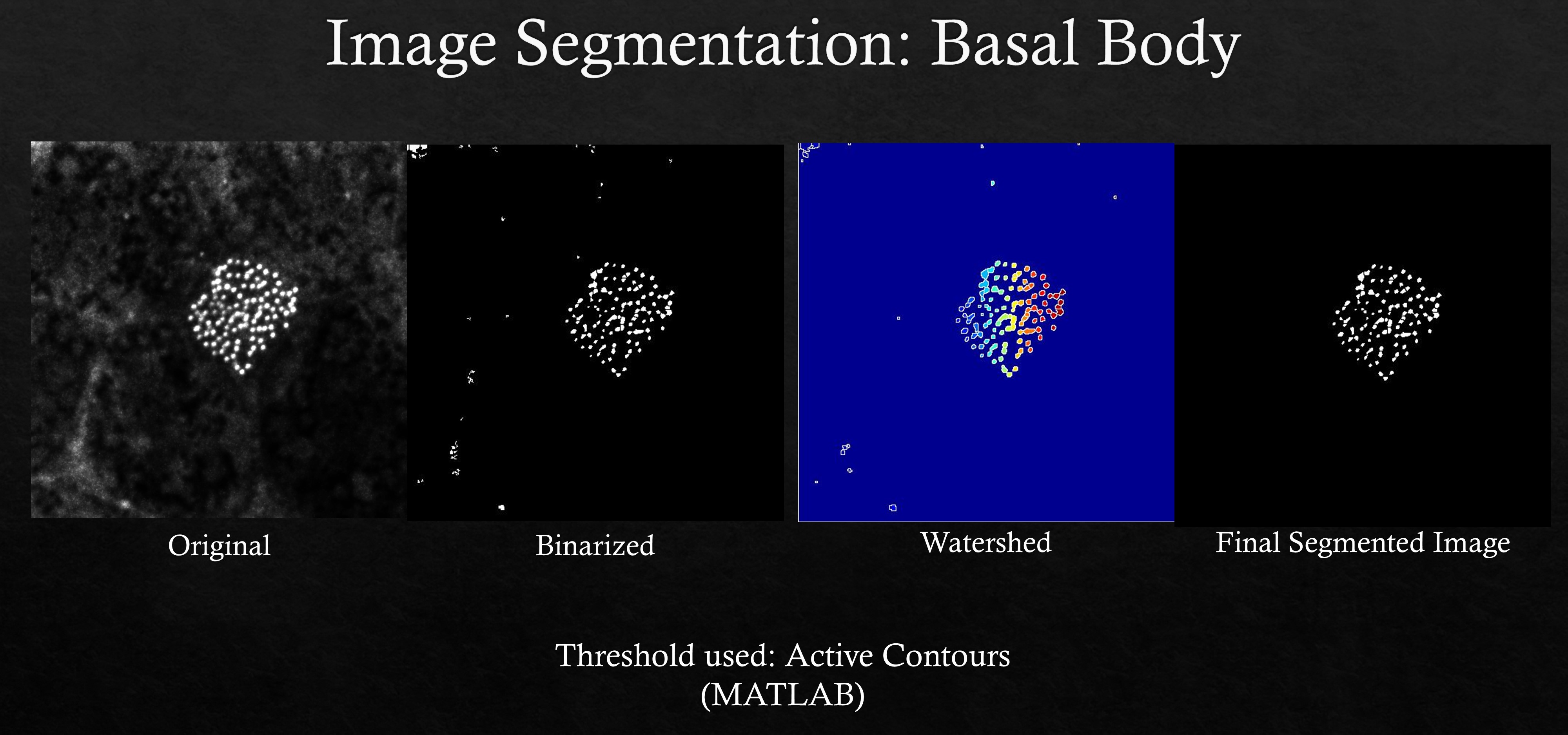 Image Segmentation Using MATLAB - Vignesh Aravind: Project Page